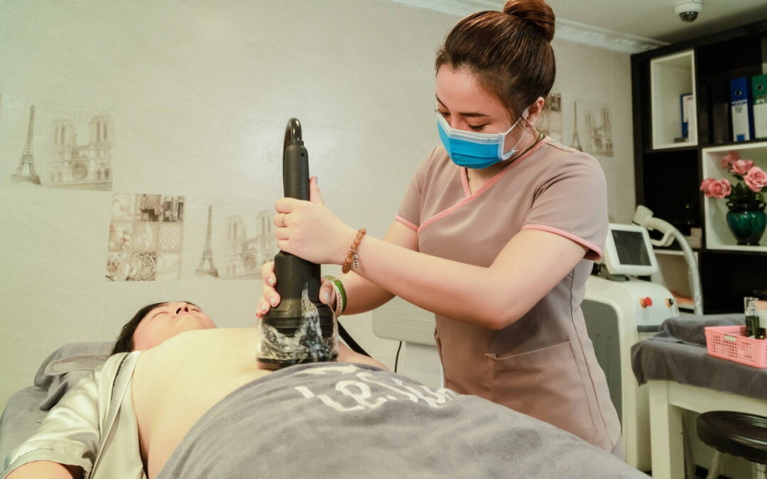 coolsculpting treatment